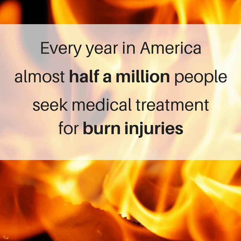 what to do after a burn injury
